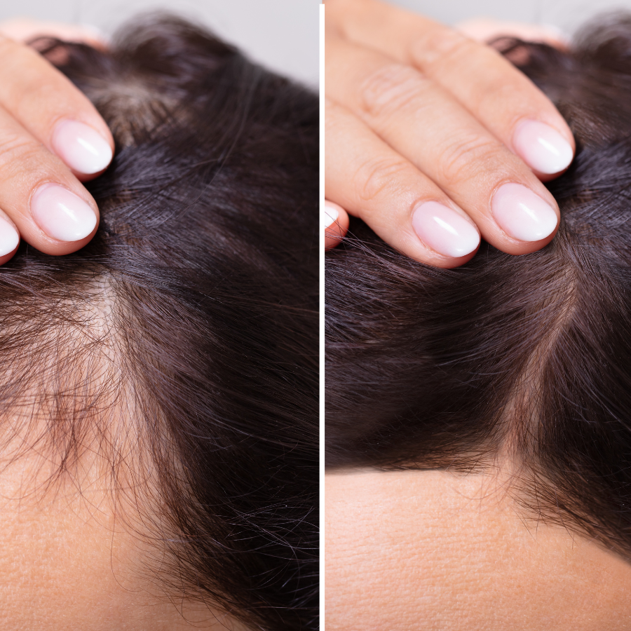 Nourish hair & scalp oil